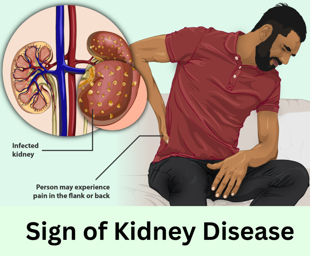 signs of kidney disease